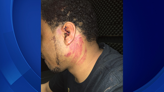 BSO said Dannie Herrington suffered these injuries at the hands of three carjackers who were armed with a handgun. (Source: Broward Sheriff's Office)